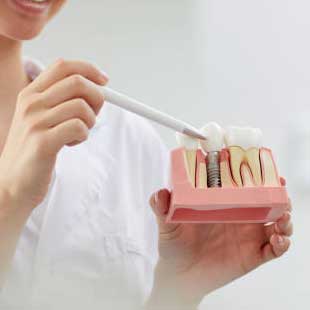 dental-implants-img