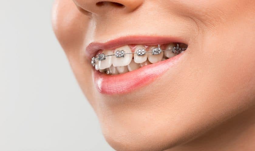 How Invisalign Dentists Use Advanced Technology