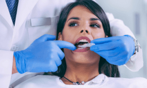Invisalign Dentist - our dentist is doing invisalign treatment