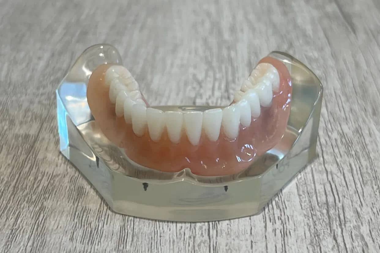 Snap-In-Implant-Denture-snapped-in-1