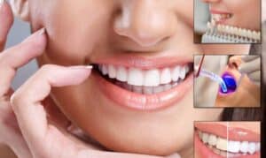 Image of cosmetic dentist-how to choose the right cosmetic dentist for your needs